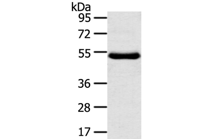 TMPRSS11D Antibody from Signalway Antibody (40346) - Antibodies.com