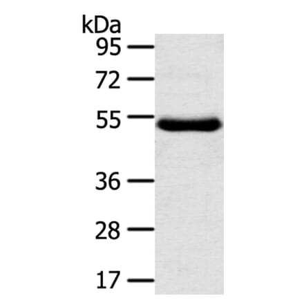 TMPRSS11D Antibody from Signalway Antibody (40346) - Antibodies.com