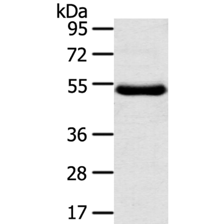 TMPRSS11D Antibody from Signalway Antibody (40346) - Antibodies.com