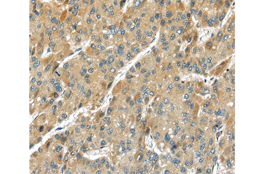 Immunohistochemistry - TMPRSS11D Antibody from Signalway Antibody (40346) - Antibodies.com