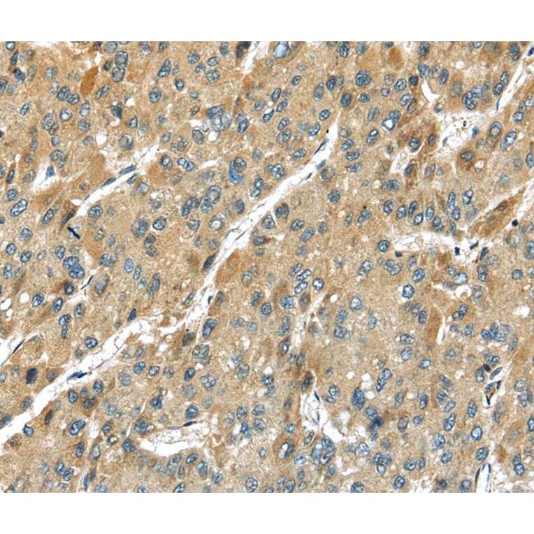 Immunohistochemistry - TMPRSS11D Antibody from Signalway Antibody (40346) - Antibodies.com