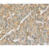 Immunohistochemistry - TMPRSS11D Antibody from Signalway Antibody (40346) - Antibodies.com