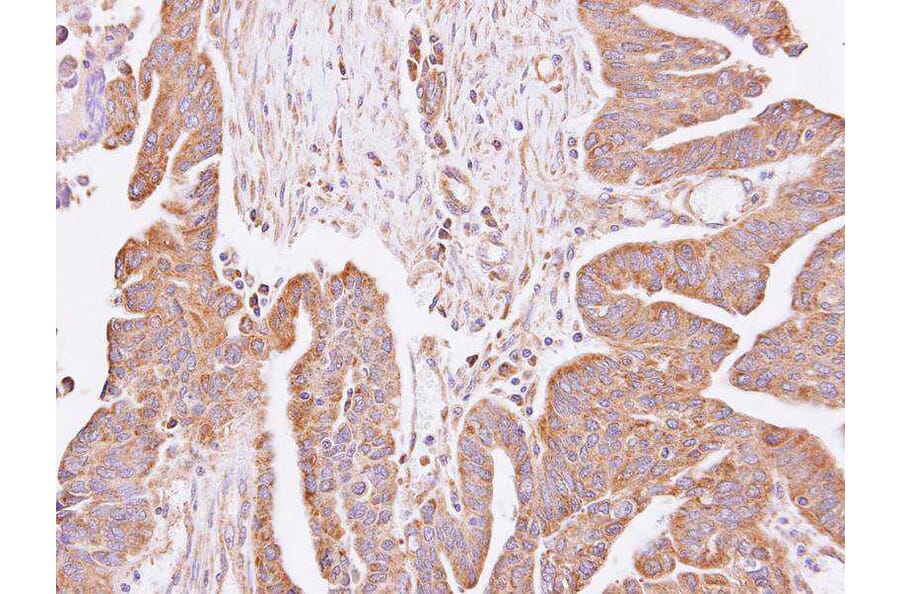 Immunohistochemistry - hypothetical protein LOC55286 antibody from Signalway Antibody (23140) - Antibodies.com
