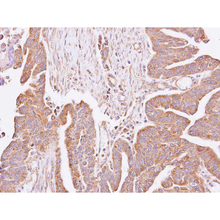Immunohistochemistry - hypothetical protein LOC55286 antibody from Signalway Antibody (23140) - Antibodies.com