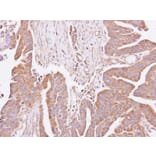 Immunohistochemistry - hypothetical protein LOC55286 antibody from Signalway Antibody (23140) - Antibodies.com