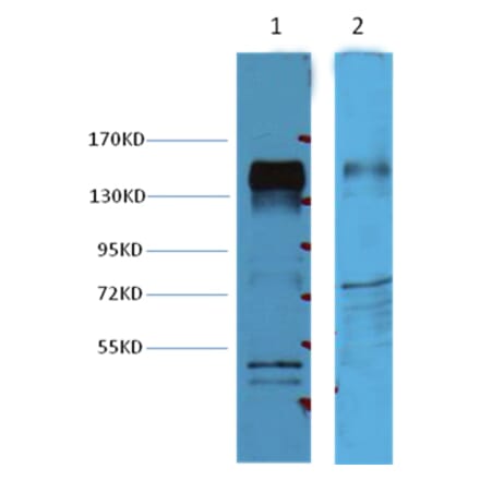 Western blot - ErbB-2/HER-2 Mouse Monoclonal Antibody from Signalway Antibody (37997) - Antibodies.com