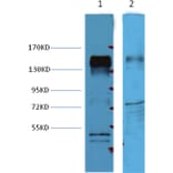 Western blot - ErbB-2/HER-2 Mouse Monoclonal Antibody from Signalway Antibody (37997) - Antibodies.com