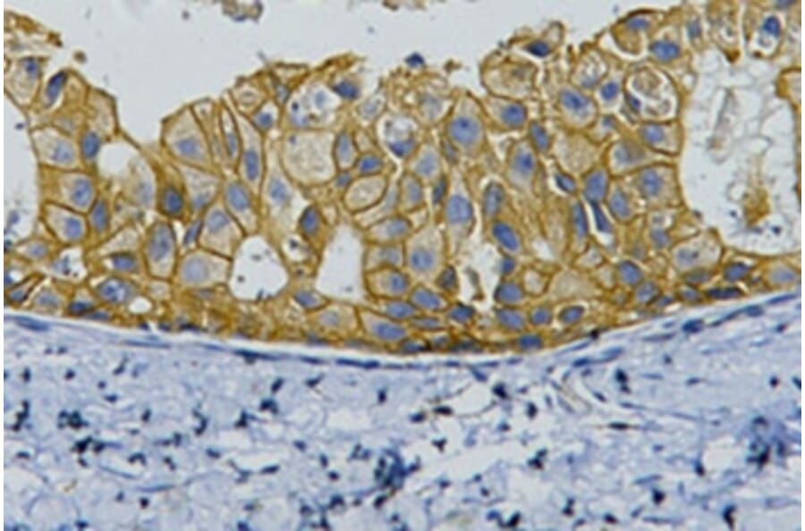 ErbB-2/HER-2 Mouse Monoclonal Antibody from Signalway Antibody (37997) - Antibodies.com