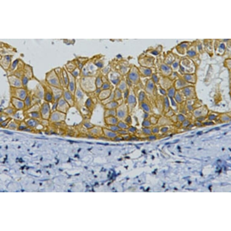 ErbB-2/HER-2 Mouse Monoclonal Antibody from Signalway Antibody (37997) - Antibodies.com