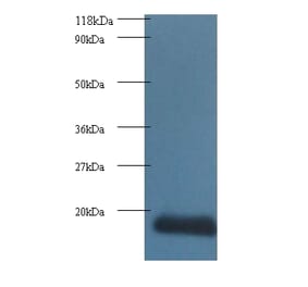 Cytidine deaminase Polyclonal Antibody from Signalway Antibody (42166) - Antibodies.com