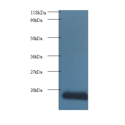 Cytidine deaminase Polyclonal Antibody from Signalway Antibody (42166) - Antibodies.com