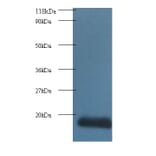 Cytidine deaminase Polyclonal Antibody from Signalway Antibody (42166) - Antibodies.com