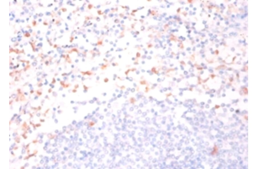 Immunohistochemistry - Cytidine deaminase Polyclonal Antibody from Signalway Antibody (42166) - Antibodies.com