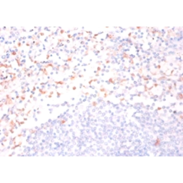 Immunohistochemistry - Cytidine deaminase Polyclonal Antibody from Signalway Antibody (42166) - Antibodies.com