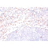 Immunohistochemistry - Cytidine deaminase Polyclonal Antibody from Signalway Antibody (42166) - Antibodies.com