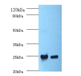 C-reactive protein Polyclonal Antibody from Signalway Antibody (42449) - Antibodies.com