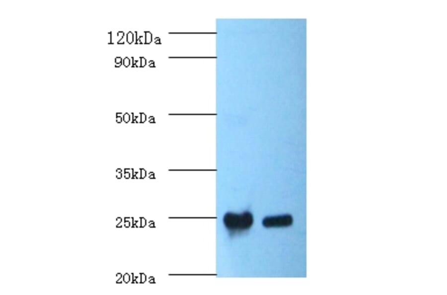 C-reactive protein Polyclonal Antibody from Signalway Antibody (42449) - Antibodies.com
