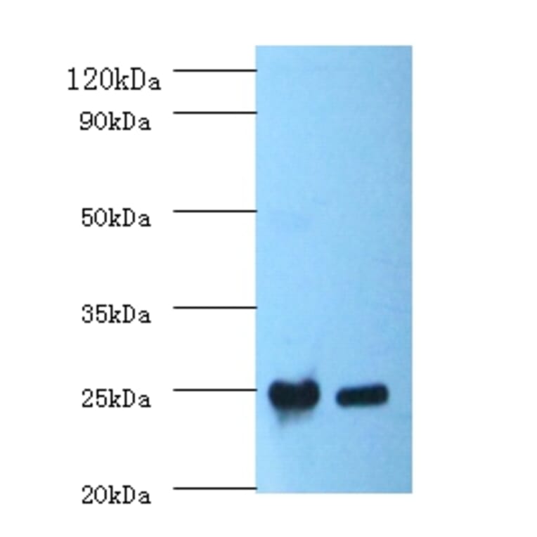 C-reactive protein Polyclonal Antibody from Signalway Antibody (42449) - Antibodies.com
