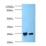 C-reactive protein Polyclonal Antibody from Signalway Antibody (42449) - Antibodies.com