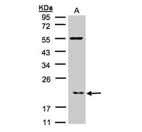 p21-ARC antibody from Signalway Antibody (22102) - Antibodies.com