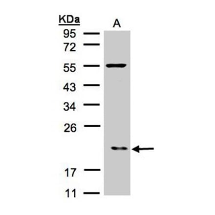 p21-ARC antibody from Signalway Antibody (22102) - Antibodies.com