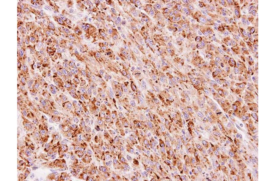 Immunohistochemistry - FLJ13946 antibody from Signalway Antibody (22118) - Antibodies.com