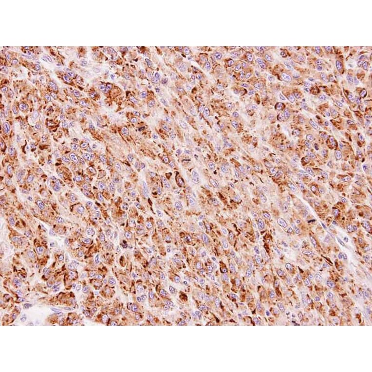 Immunohistochemistry - FLJ13946 antibody from Signalway Antibody (22118) - Antibodies.com