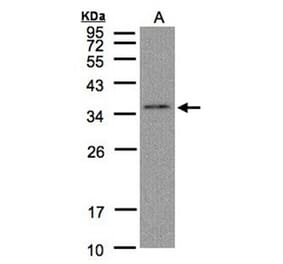 C17orf25 antibody from Signalway Antibody (22181) - Antibodies.com