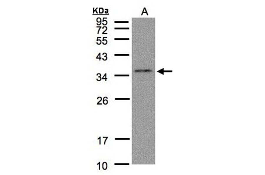 C17orf25 antibody from Signalway Antibody (22181) - Antibodies.com