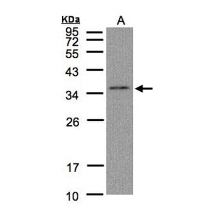 C17orf25 antibody from Signalway Antibody (22181) - Antibodies.com