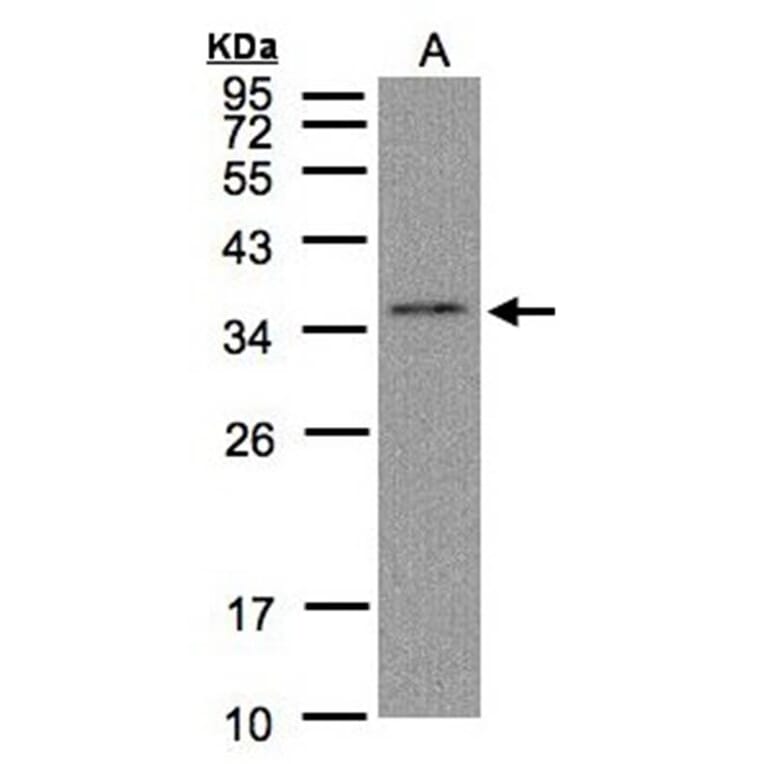 C17orf25 antibody from Signalway Antibody (22181) - Antibodies.com