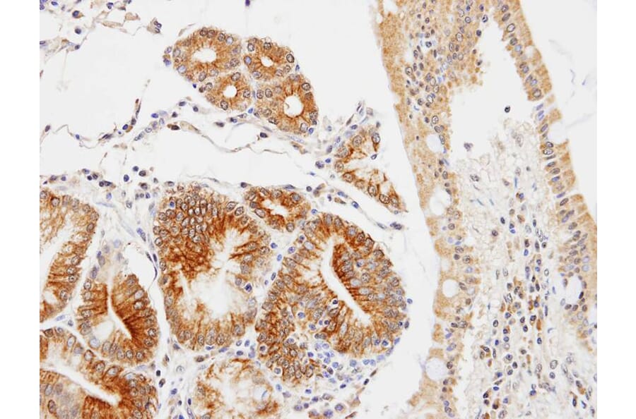 Immunohistochemistry - C17orf25 antibody from Signalway Antibody (22181) - Antibodies.com