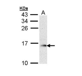 GMF-beta antibody from Signalway Antibody (22324) - Antibodies.com