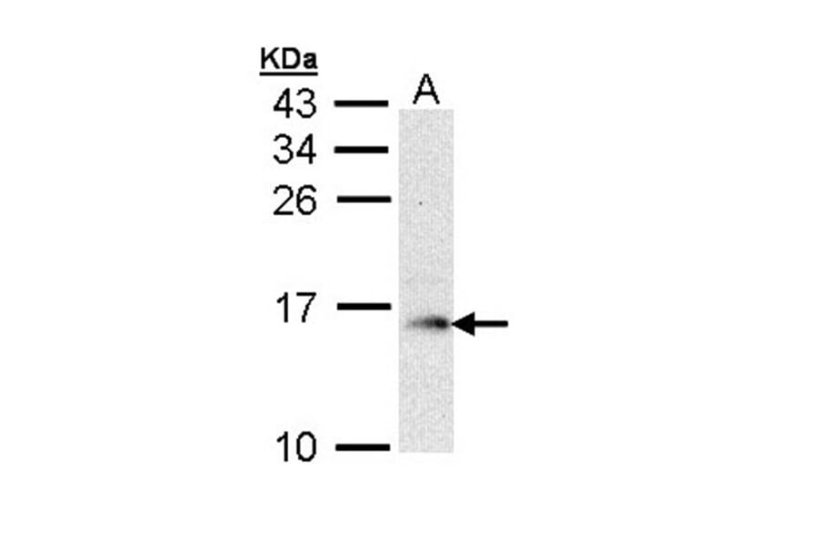 GMF-beta antibody from Signalway Antibody (22324) - Antibodies.com