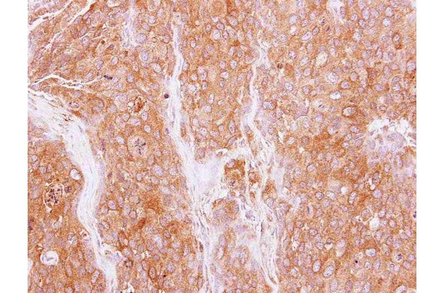 Immunohistochemistry - GMF-beta antibody from Signalway Antibody (22324) - Antibodies.com