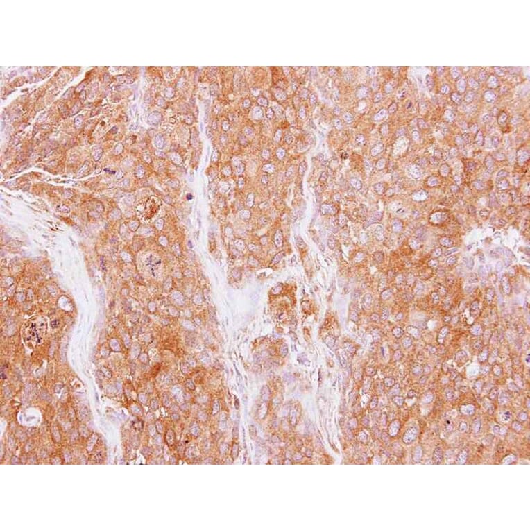 Immunohistochemistry - GMF-beta antibody from Signalway Antibody (22324) - Antibodies.com