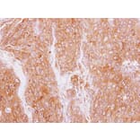 Immunohistochemistry - GMF-beta antibody from Signalway Antibody (22324) - Antibodies.com