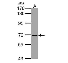 SLC25A13 antibody from Signalway Antibody (22329) - Antibodies.com