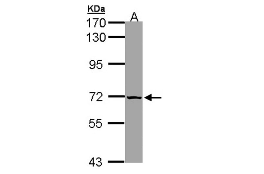 SLC25A13 antibody from Signalway Antibody (22329) - Antibodies.com