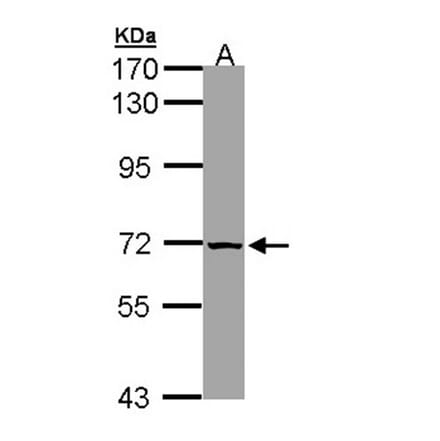 SLC25A13 antibody from Signalway Antibody (22329) - Antibodies.com