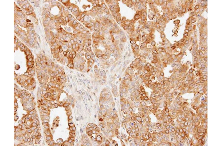 Immunohistochemistry - SLC25A13 antibody from Signalway Antibody (22329) - Antibodies.com