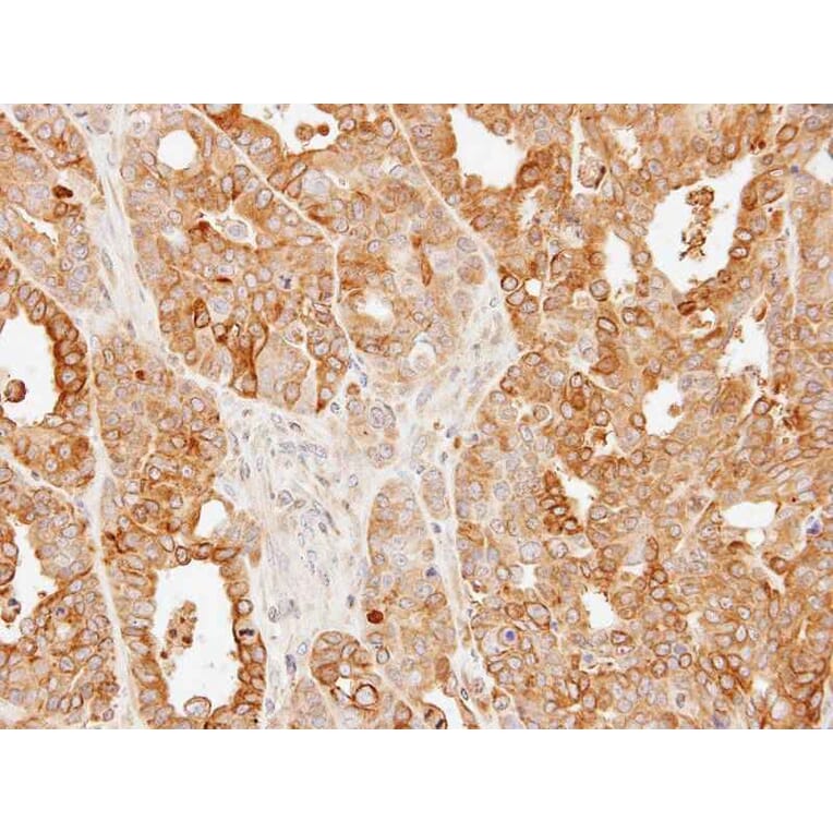 Immunohistochemistry - SLC25A13 antibody from Signalway Antibody (22329) - Antibodies.com