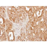 Immunohistochemistry - SLC25A13 antibody from Signalway Antibody (22329) - Antibodies.com