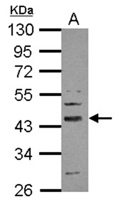 Sample (50 µg of whole cell lysate)  White adipose 10% SDS PAGE Primary antibody diluted at 1: 1000
