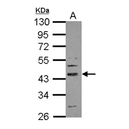 SERPINI2 antibody from Signalway Antibody (22380) - Antibodies.com