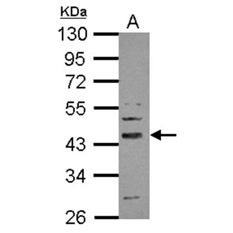 SERPINI2 antibody from Signalway Antibody (22380) - Antibodies.com