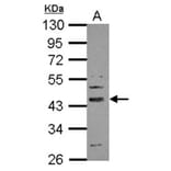 SERPINI2 antibody from Signalway Antibody (22380) - Antibodies.com