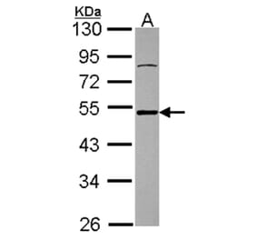 Ataxin 3 antibody from Signalway Antibody (22437) - Antibodies.com