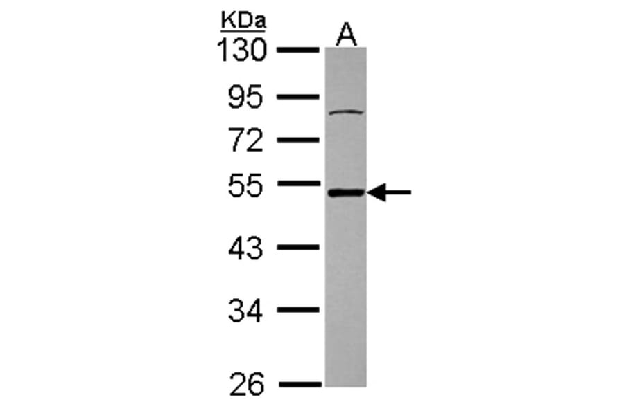 Ataxin 3 antibody from Signalway Antibody (22437) - Antibodies.com