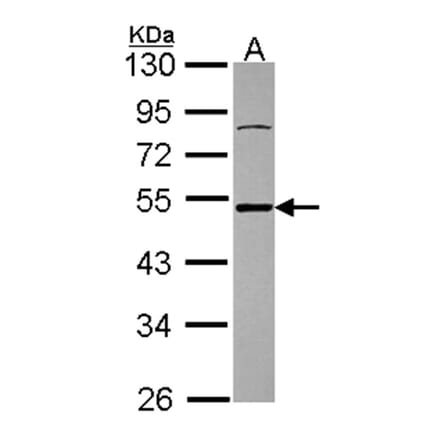 Ataxin 3 antibody from Signalway Antibody (22437) - Antibodies.com